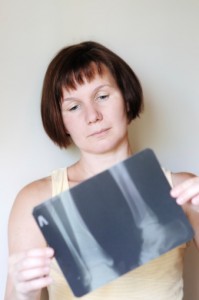 Vague Georgia Personal Injury Damages