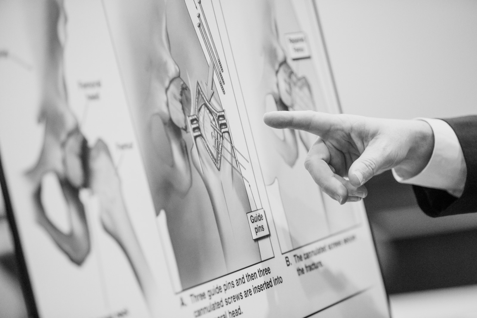 Hip Surgery diagram presented in court