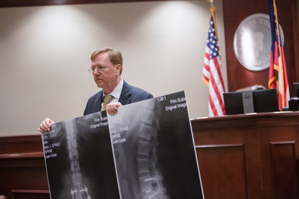 Spinal X-ray of an Injured Client presented in court by Senior Attorney, Bruce Millar