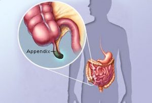 Please Don’t Remove Your Own Appendix