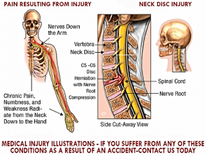 Watch Your Neck When Driving on Athens Highway
