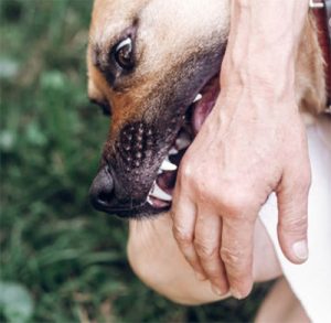 A dog biting a persons hand