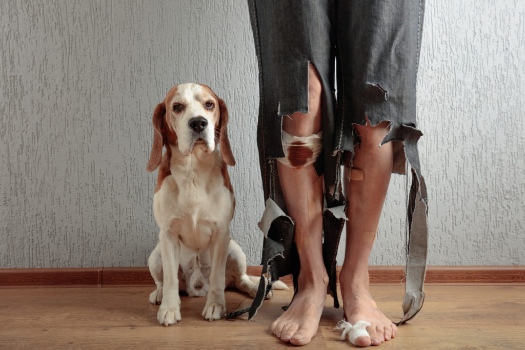 Closeup view of a man with torn jeans and various bandages on his lower legs and feet, standing next to his cute Beagle who does not seem to notice the problem